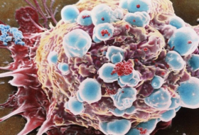 Gentler attack on cancer may mean we can live with it for longer